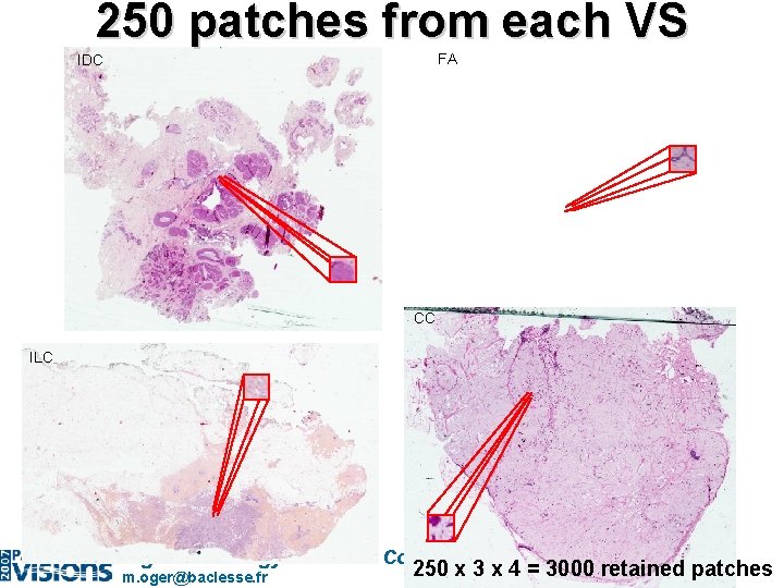 250 patches from each VS FA IDC CC ILC Digital Pathology Solutions Conference m.