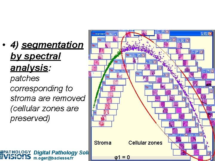  • 4) segmentation by spectral analysis: patches corresponding to stroma are removed (cellular