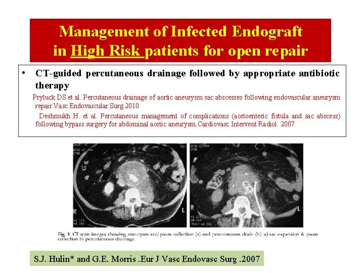 Management of Infected Endograft in High Risk patients for open repair • CT-guided percutaneous Management of Infected Endograft in High Risk patients for open repair • CT-guided percutaneous