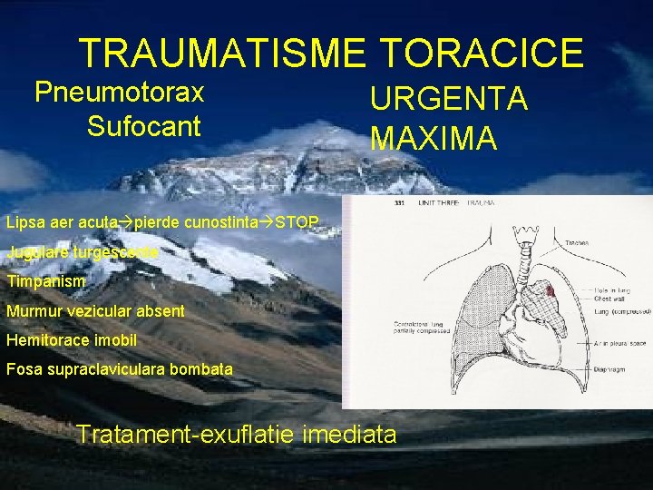 TRAUMATISME TORACICE Pneumotorax Sufocant URGENTA MAXIMA Lipsa aer acuta pierde cunostinta STOP Jugulare turgescente