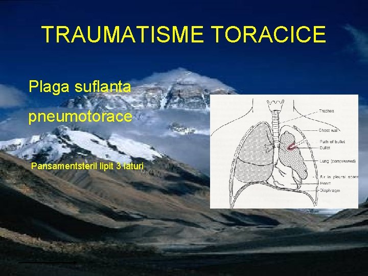 TRAUMATISME TORACICE Plaga suflanta pneumotorace Pansamentsteril lipit 3 laturi 