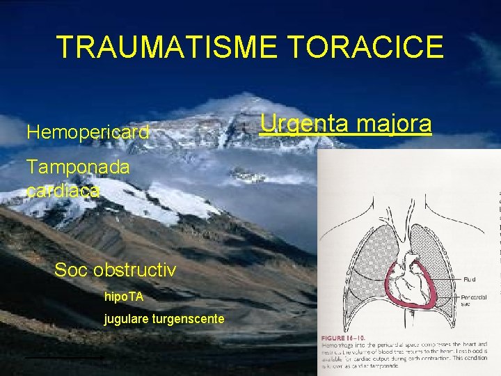 TRAUMATISME TORACICE Hemopericard Tamponada cardiaca Soc obstructiv hipo. TA jugulare turgenscente Urgenta majora 