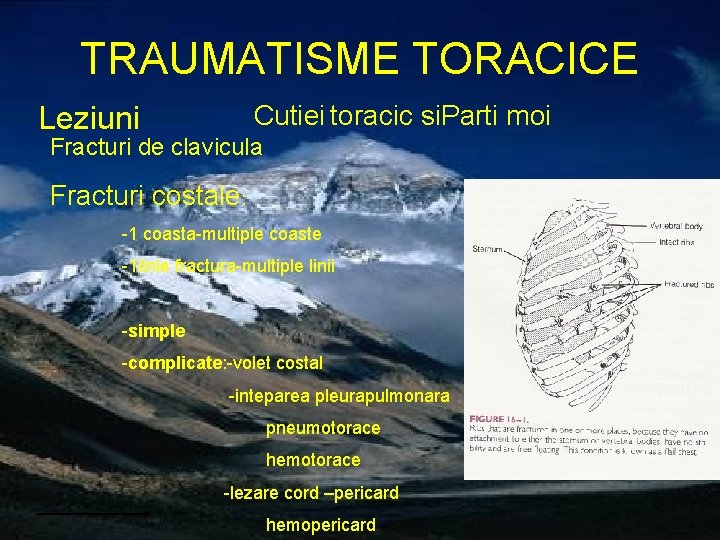 TRAUMATISME TORACICE Cutiei toracic si. Parti moi Leziuni Fracturi de clavicula Fracturi costale: -1