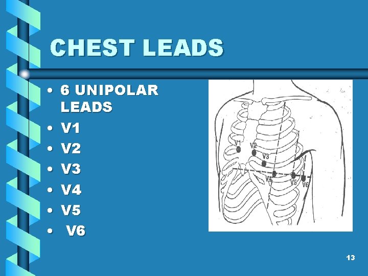 CHEST LEADS • 6 UNIPOLAR LEADS • V 1 • V 2 • V