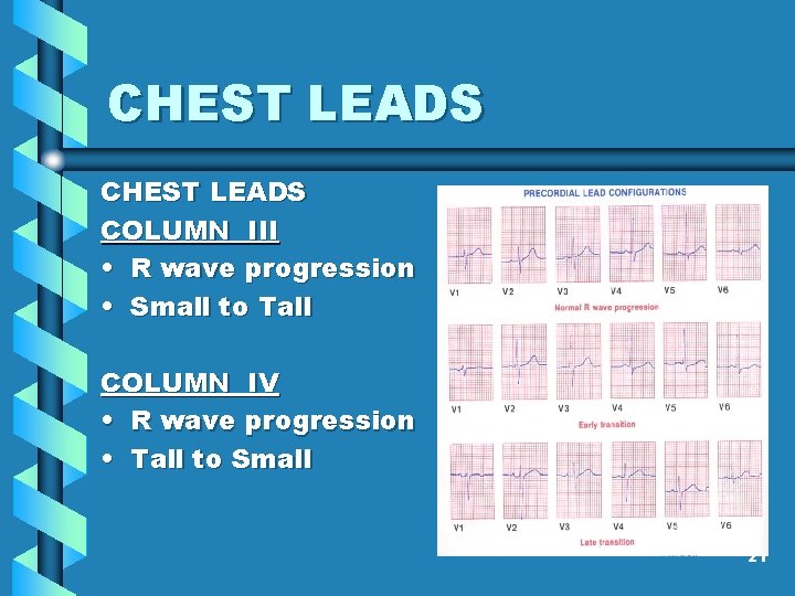 CHEST LEADS COLUMN III • R wave progression • Small to Tall COLUMN IV