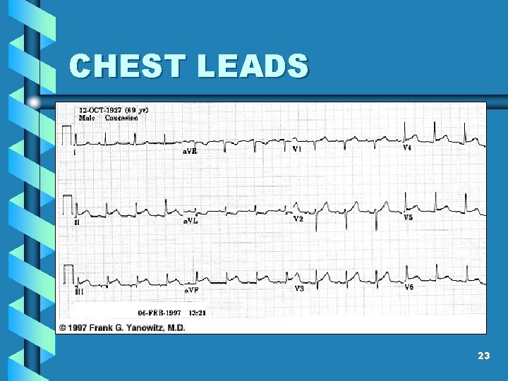 CHEST LEADS 23 