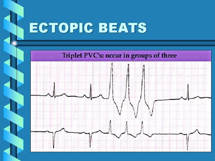 ECTOPIC BEATS 44 