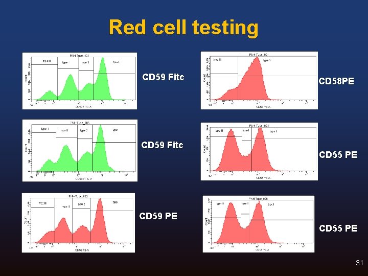 Red cell testing CD 59 Fitc CD 58 PE CD 55 PE CD 59