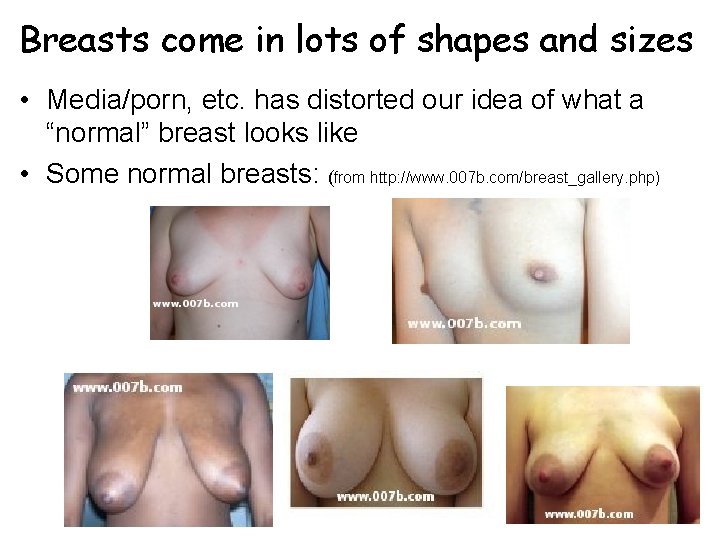 Breasts come in lots of shapes and sizes • Media/porn, etc. has distorted our Breasts come in lots of shapes and sizes • Media/porn, etc. has distorted our