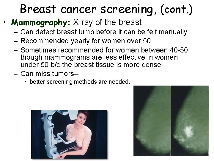 Breast cancer screening, (cont. ) • Mammography: X-ray of the breast – Can detect Breast cancer screening, (cont. ) • Mammography: X-ray of the breast – Can detect