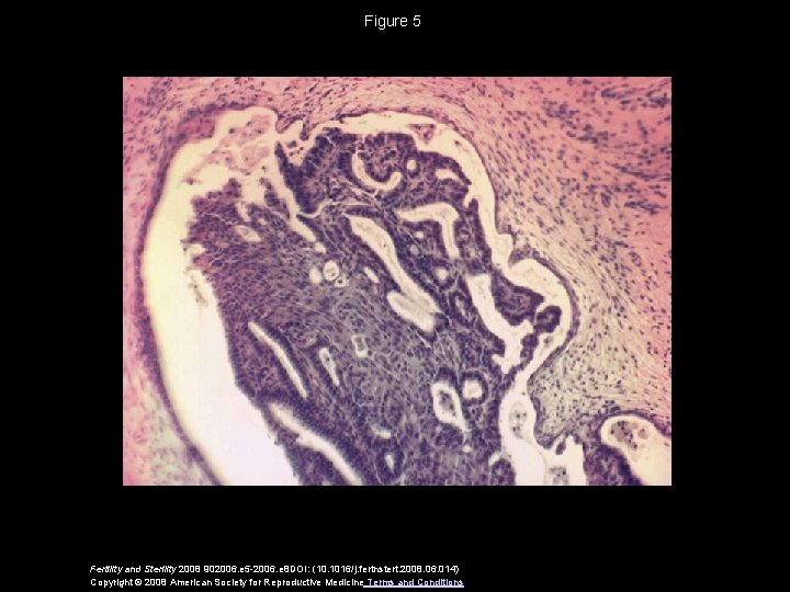 Figure 5 Fertility and Sterility 2008 902006. e 5 -2006. e 8 DOI: (10.