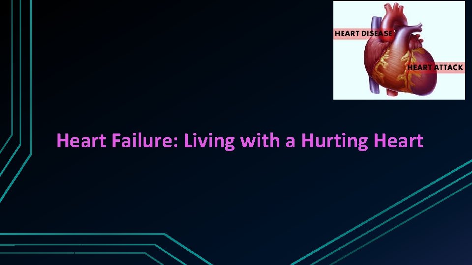 Heart Failure: Living with a Hurting Heart 