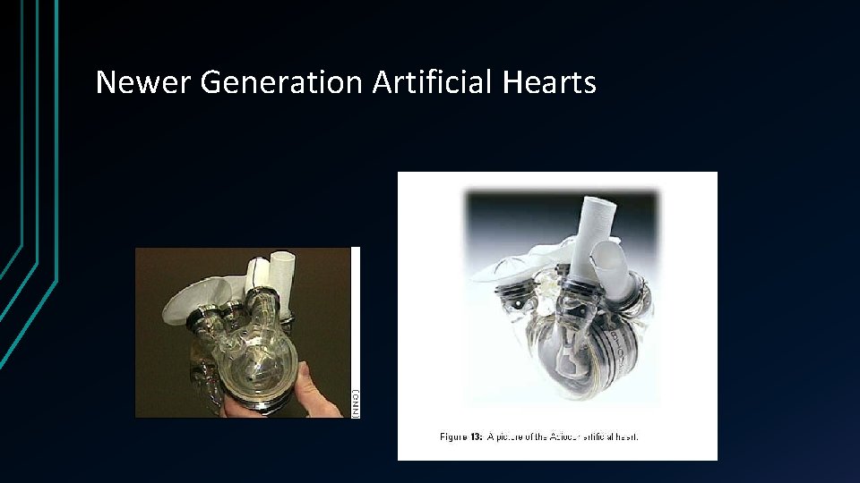 Newer Generation Artificial Hearts 