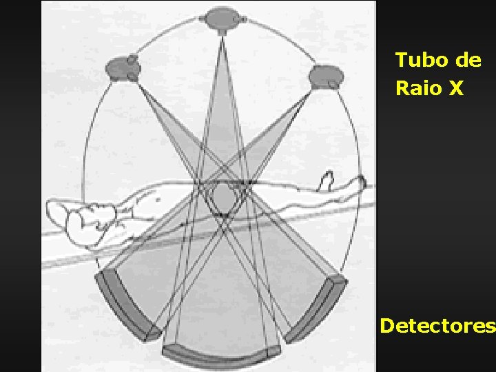 Tubo de Raio X Detectores 