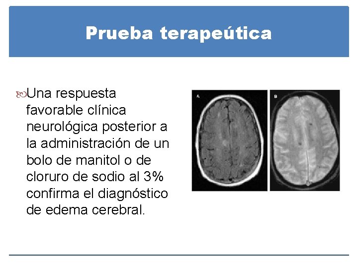 Prueba terapeútica Una respuesta favorable clínica neurológica posterior a la administración de un bolo Prueba terapeútica Una respuesta favorable clínica neurológica posterior a la administración de un bolo