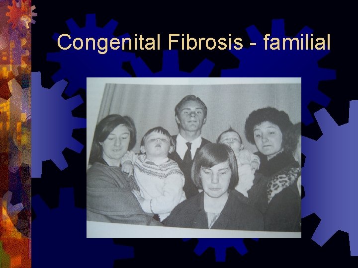 Congenital Fibrosis - familial 