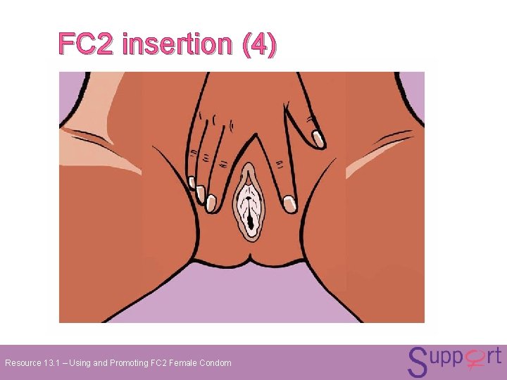 FC 2 insertion (4) Resource 13. 1 – Using and Promoting FC 2 Female FC 2 insertion (4) Resource 13. 1 – Using and Promoting FC 2 Female