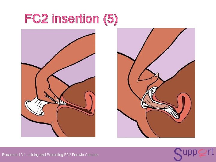 FC 2 insertion (5) Resource 13. 1 – Using and Promoting FC 2 Female FC 2 insertion (5) Resource 13. 1 – Using and Promoting FC 2 Female