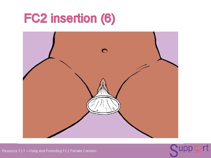 FC 2 insertion (6) Resource 13. 1 – Using and Promoting FC 2 Female FC 2 insertion (6) Resource 13. 1 – Using and Promoting FC 2 Female