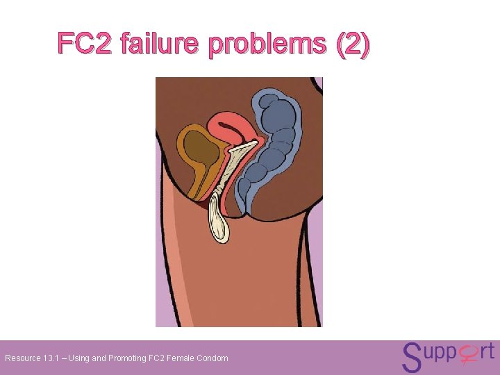 FC 2 failure problems (2) Resource 13. 1 – Using and Promoting FC 2 FC 2 failure problems (2) Resource 13. 1 – Using and Promoting FC 2