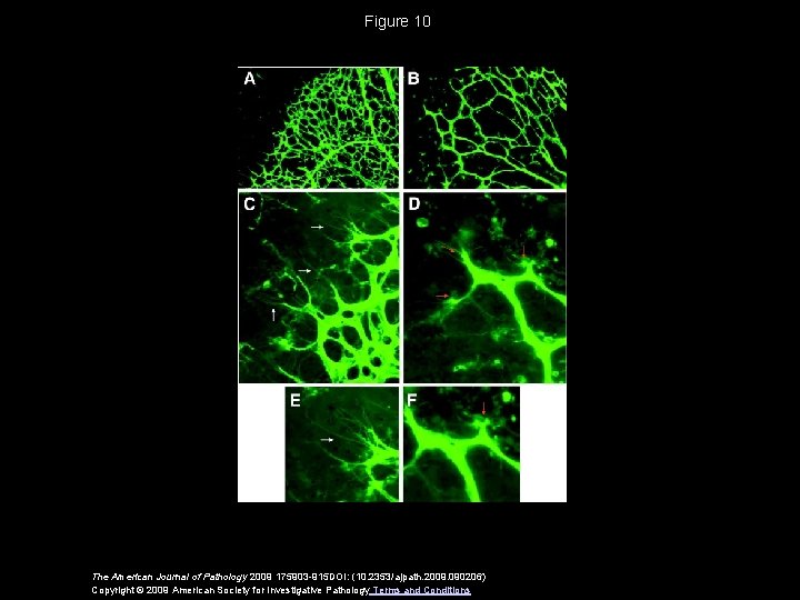 Figure 10 The American Journal of Pathology 2009 175903 -915 DOI: (10. 2353/ajpath. 2009.