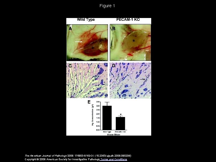 Figure 1 The American Journal of Pathology 2009 175903 -915 DOI: (10. 2353/ajpath. 2009.