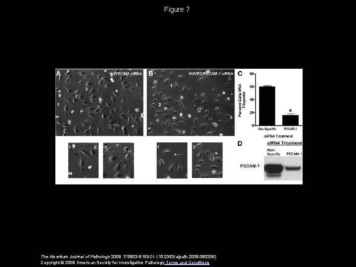 Figure 7 The American Journal of Pathology 2009 175903 -915 DOI: (10. 2353/ajpath. 2009.