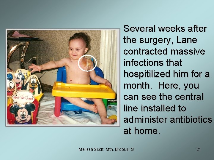 Several weeks after the surgery, Lane contracted massive infections that hospitilized him for a