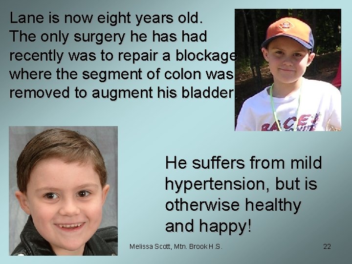 Lane is now eight years old. The only surgery he has had recently was