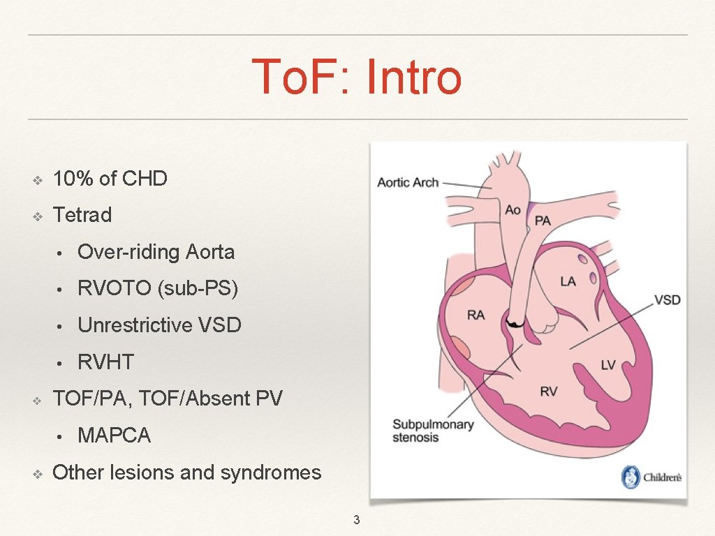 To. F: Intro ❖ 10% of CHD ❖ Tetrad ❖ • Over-riding Aorta •