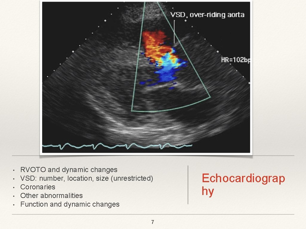  • • • RVOTO and dynamic changes VSD: number, location, size (unrestricted) Coronaries