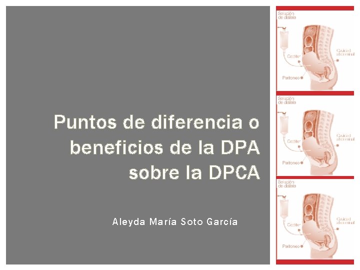 Puntos de diferencia o beneficios de la DPA sobre la DPCA Aleyda María Soto