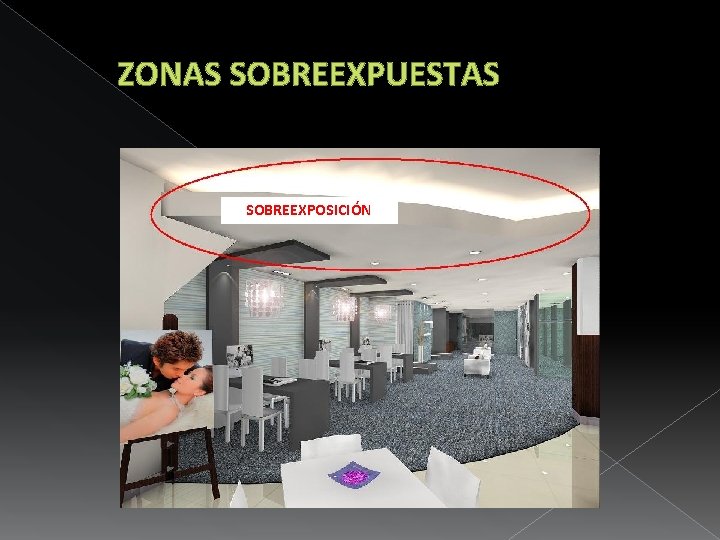 ZONAS SOBREEXPUESTAS SOBREEXPOSICIÓN 