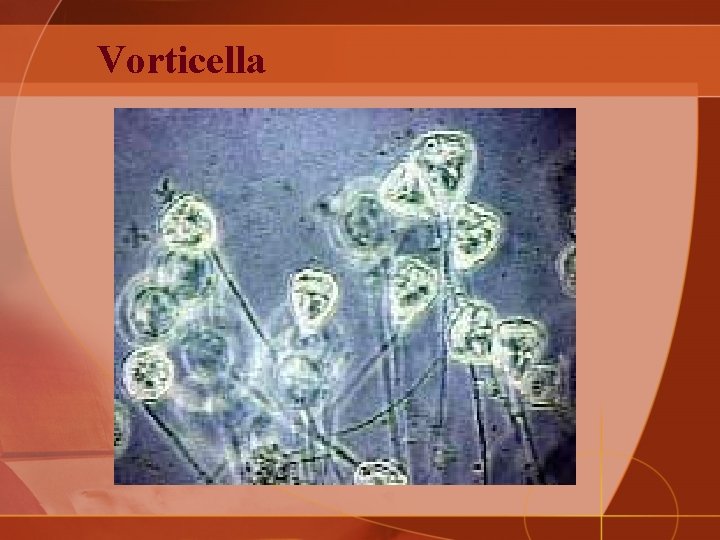 Vorticella 