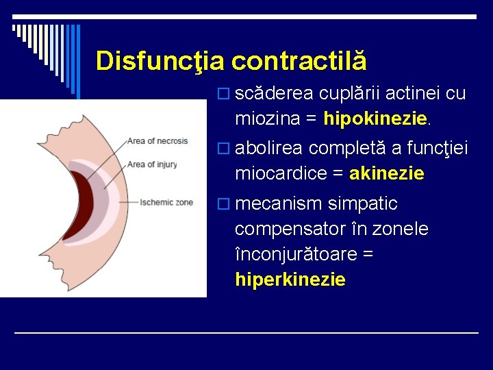 Disfuncţia contractilă o scăderea cuplării actinei cu miozina = hipokinezie. o abolirea completă a