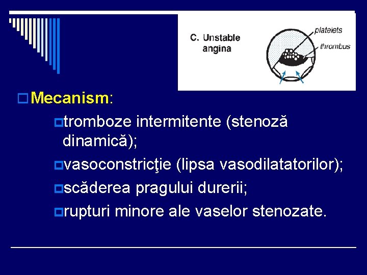 o Mecanism: ptromboze intermitente (stenoză dinamică); pvasoconstricţie (lipsa vasodilatatorilor); pscăderea pragului durerii; prupturi minore