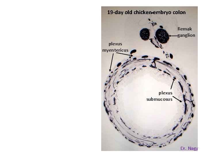 19 -day old chicken embryo colon Remak ganglion plexus myentericus plexus submucosus Dr. Nagy