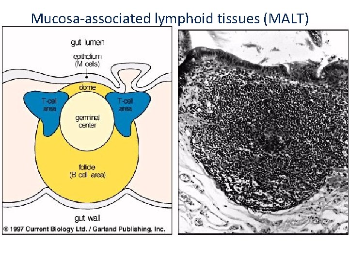  Mucosa-associated lymphoid tissues (MALT) 