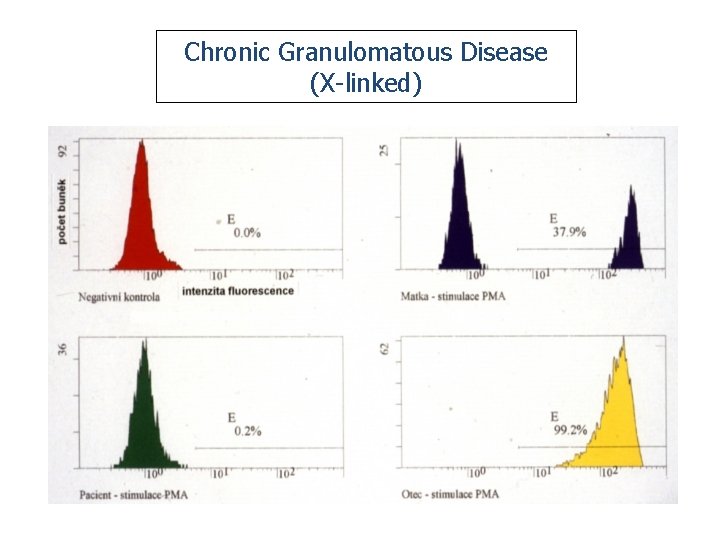 Chronic Granulomatous Disease (X-linked) 