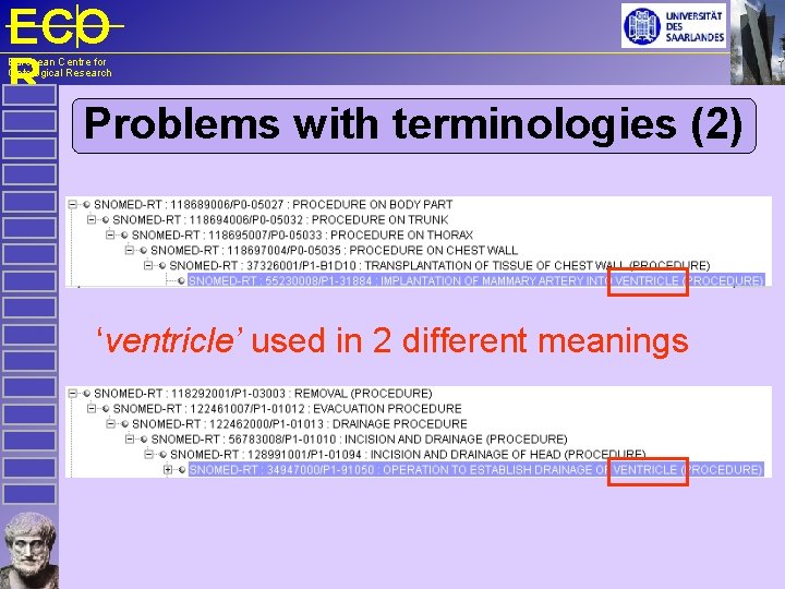 ECO R European Centre for Ontological Research Problems with terminologies (2) ‘ventricle’ used in