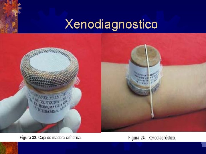 Xenodiagnostico 