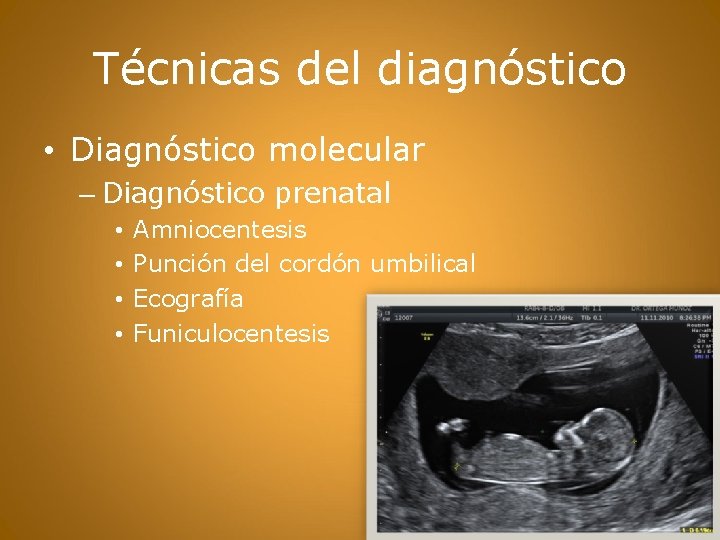 Técnicas del diagnóstico • Diagnóstico molecular – Diagnóstico prenatal • • Amniocentesis Punción del