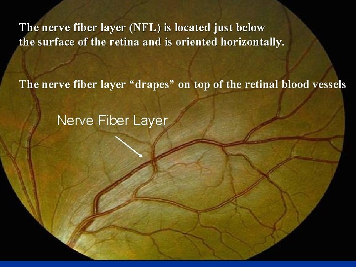 The nerve fiber layer (NFL) is located just below the surface of the retina