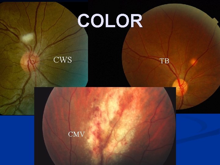 COLOR CWS CMV TB 