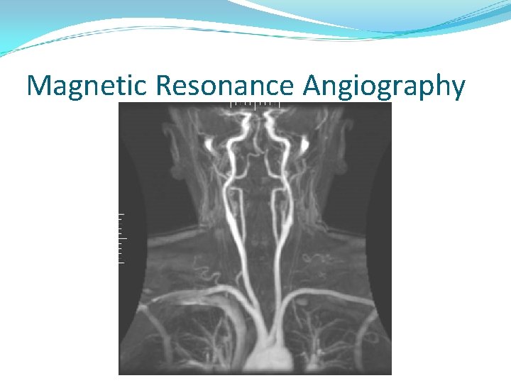 Magnetic Resonance Angiography 