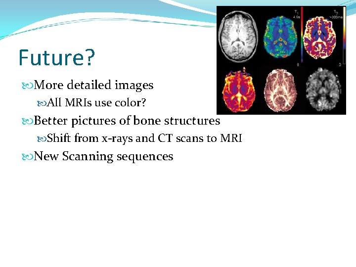 Future? More detailed images All MRIs use color? Better pictures of bone structures Shift