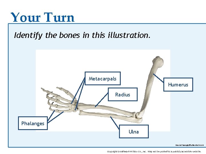 Your Turn Identify the bones in this illustration. Metacarpals Humerus Radius Phalanges Ulna Henri