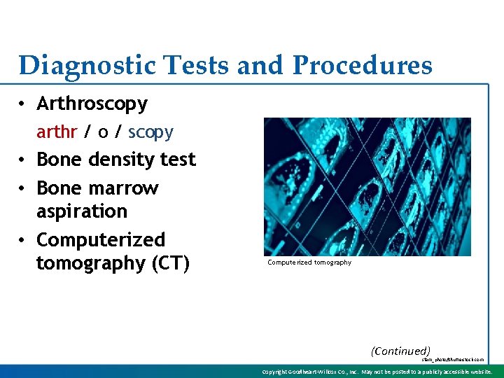 Diagnostic Tests and Procedures • Arthroscopy arthr / o / scopy • Bone density