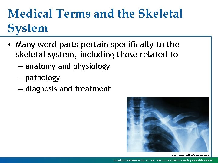 Medical Terms and the Skeletal System • Many word parts pertain specifically to the