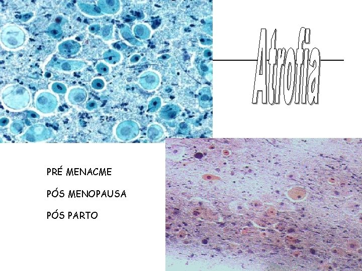 PRÉ MENACME PÓS MENOPAUSA PÓS PARTO 